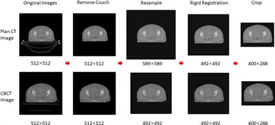 A Comparison Study Between CNN-Based Deformed Planning CT and CycleGAN-Based Synthetic CT Methods for Improving iCBCT Image Quality